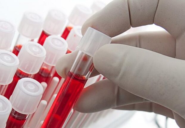 asins analīzes pēc alkohola lietošanas